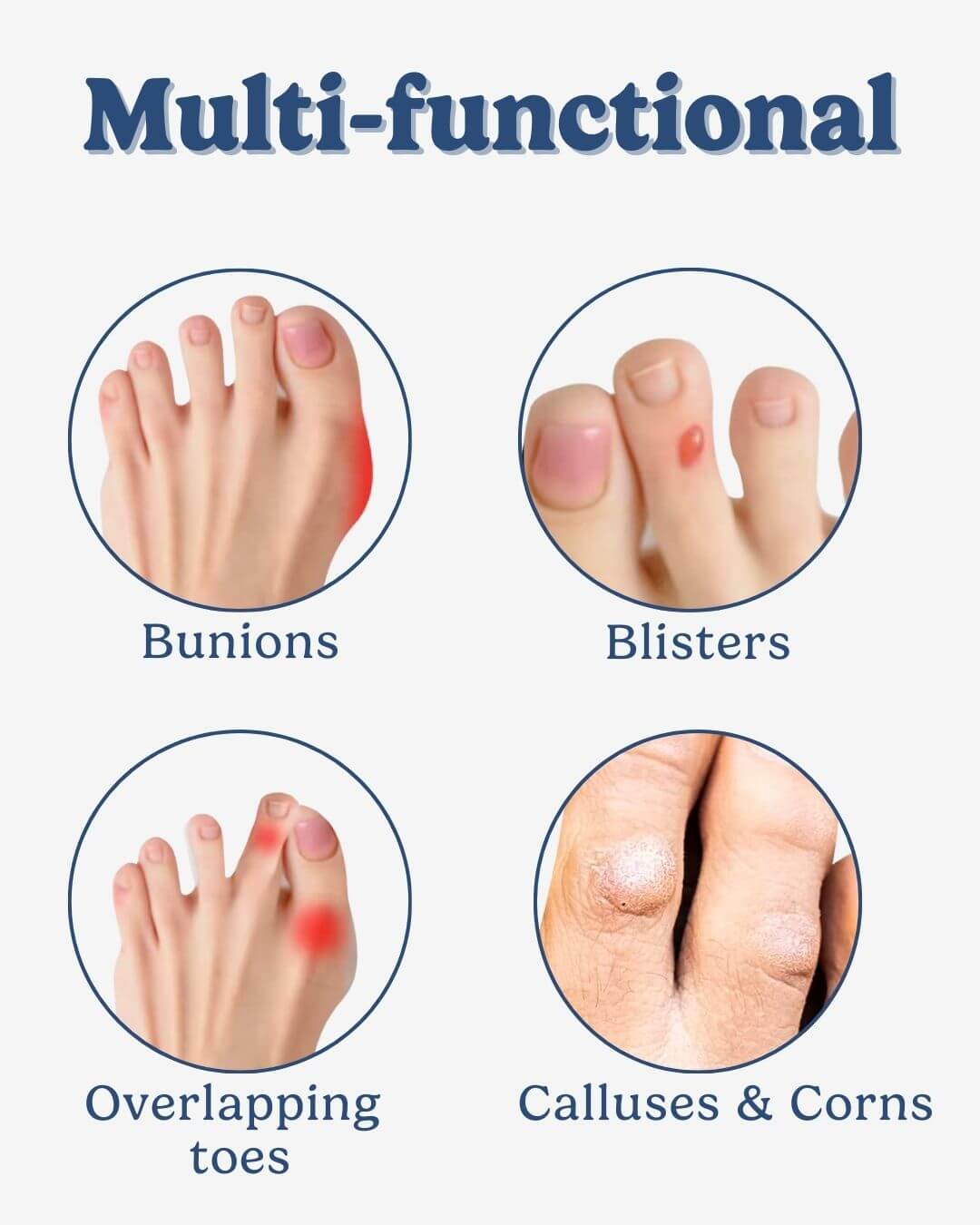Infographic listing uses for the toe separator bandage: bunions, blisters, overlapping toes, calluses and corns